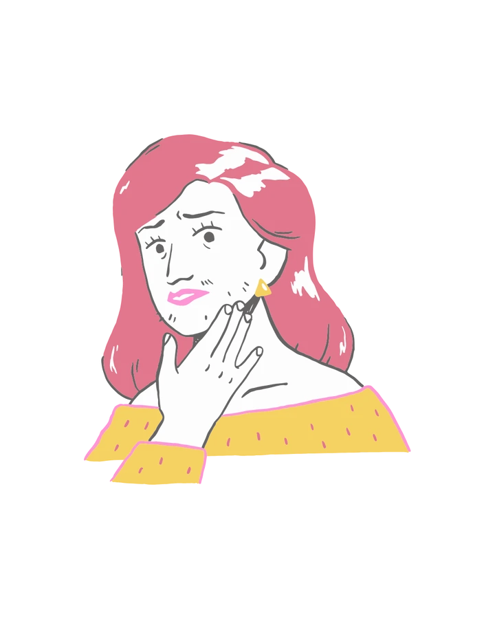 Acne illustration